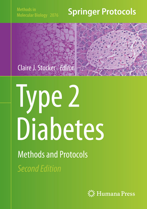 Type 2 Diabetes - 