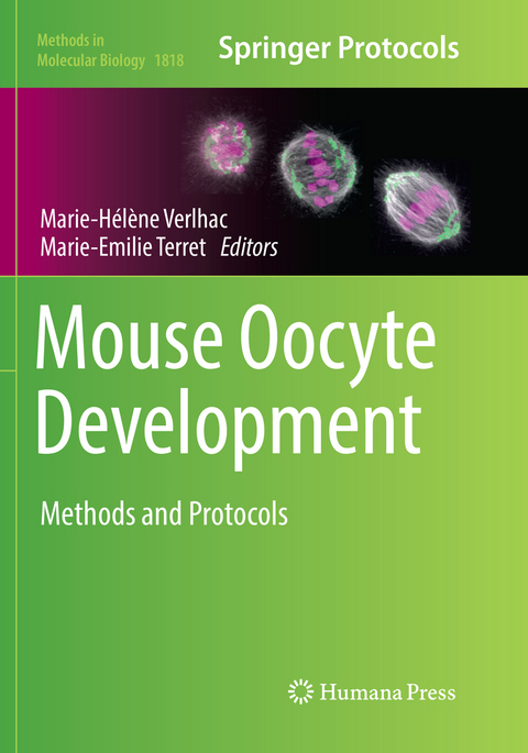 Mouse Oocyte Development - 