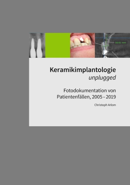 Keramikimplantologie unplugged - Christoph Arlom