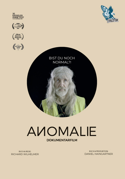 Anomalie