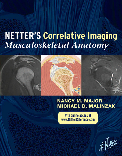 Netter Correlative Imaging: Musculoskeletal Anatomy E-book -  Nancy M. Major,  Michael D. Malinzak