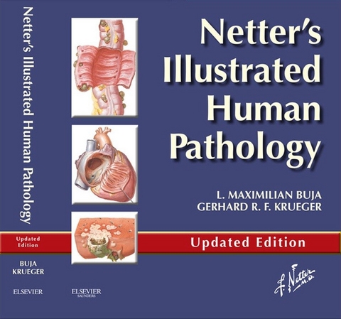 Netter's Illustrated Human Pathology Updated Edition E-book -  L. Maximilian Buja,  Gerhard R. F. Krueger