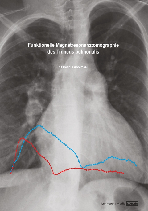 Funktionelle Magnetresonanztomographie des Truncus pulmonalis - Nasreddin Abolmaali