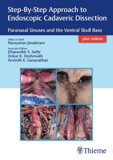 Step-By-Step Approach to Endoscopic Cadaveric Dissection, ed 1 - 