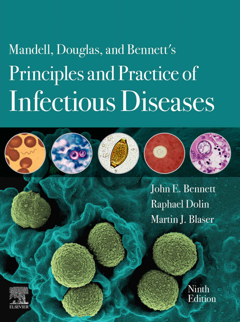 Mandell, Douglas, and Bennett's Principles and Practice of Infectious Diseases - John E. Bennett, Raphael Dolin, Martin J. Blaser