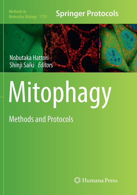 Mitophagy - 