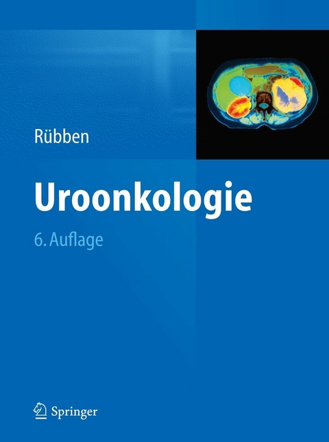 Uroonkologie - 