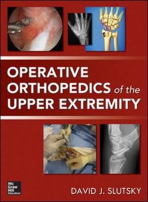 Operative Orthopedics of the Upper Extremity -  David Slutsky