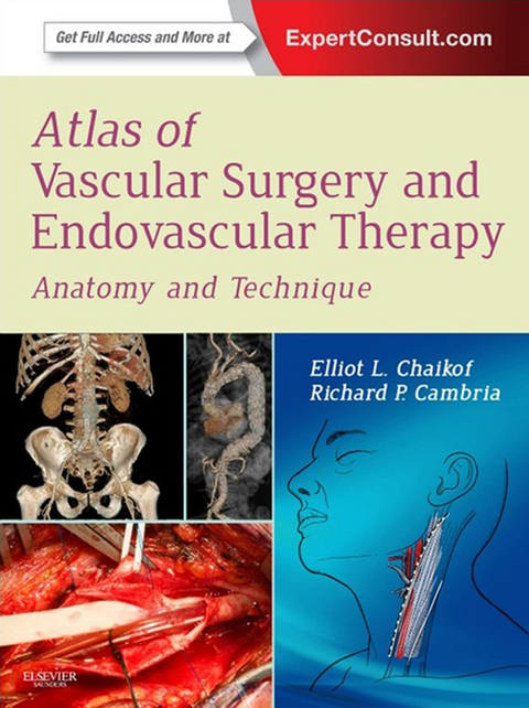 Atlas of Vascular Surgery and Endovascular Therapy -  Elliot L. Chaikof