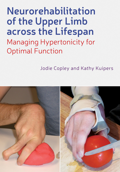 Neurorehabilitation of the Upper Limb Across the Lifespan -  Jodie Copley,  Kathy Kuipers