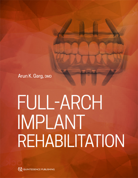 Full-Arch Implant Rehabilitation - Arun Garg