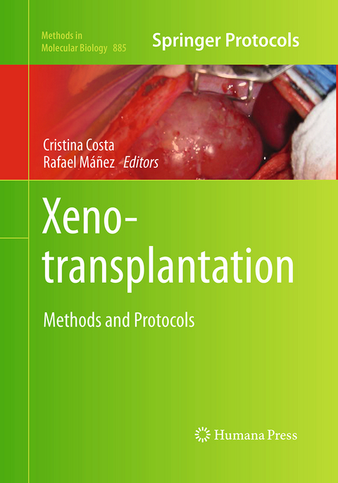 Xenotransplantation - 