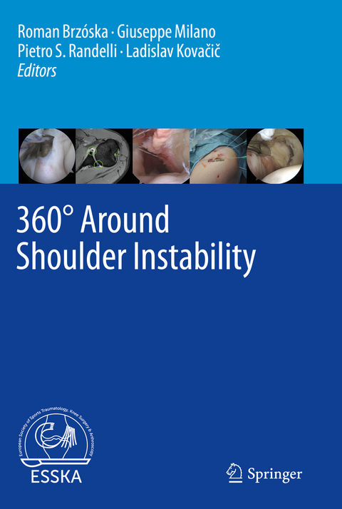 360° Around Shoulder Instability - 