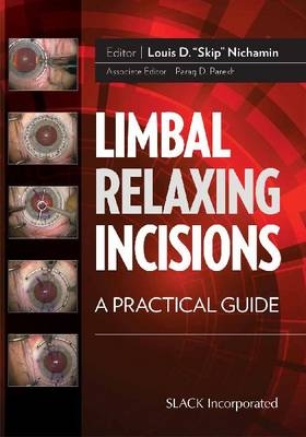 Limbal Relaxing Incisions - 