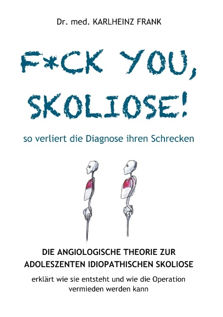 F*ck you, Skoliose! So verliert die Diagnose ihren Schrecken - Karlheinz Frank