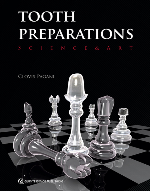 Tooth Preparations - Clovis Pagani