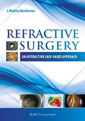 Refractive Surgery - 