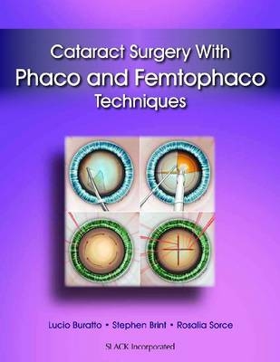 Cataract Surgery With Phaco and Femtophaco Techniques - 