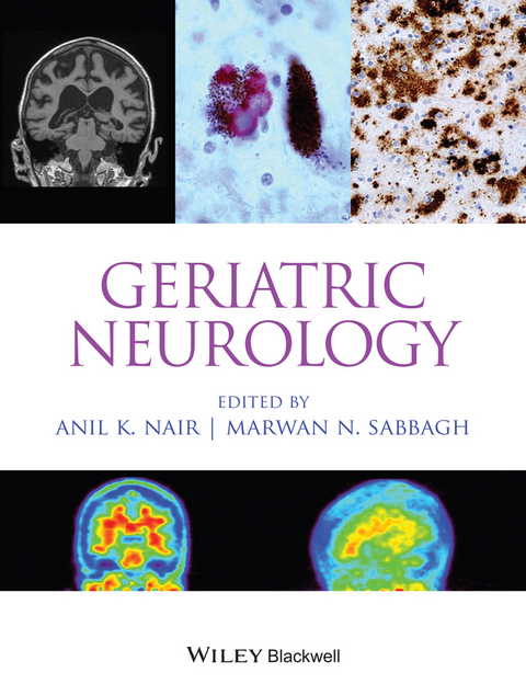 Geriatric Neurology - 