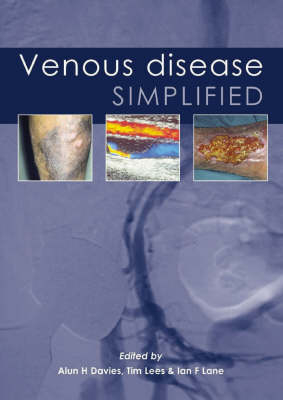 Venous Disease Simplified - 