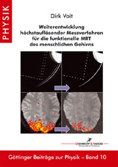 Weiterentwicklung höchstauflösender Messverfahren für die funktionelle MRT des menschlichen Gehirns - Dirk Voit