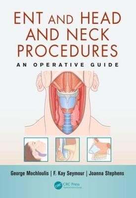 ENT and Head and Neck Procedures - Department of ENT George (Consultant ENT and Head and Neck Surgeon  Lister Hospital  Stevenage  UK) Mochloulis, Department of ENT F. Kay (Consultant ENT Surgeon  The Royal London Hospital  London  UK) Seymour, Throat Nose &amp Joanna (ENT SpR; London Ear Hospital  UK) Stephens