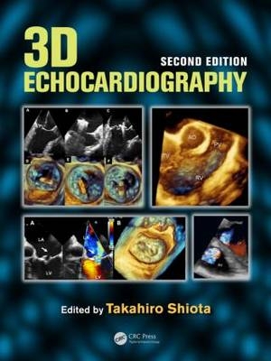 3D Echocardiography - 