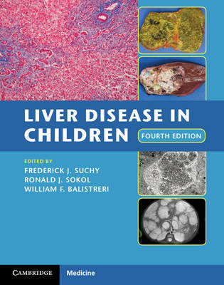 Liver Disease in Children - 