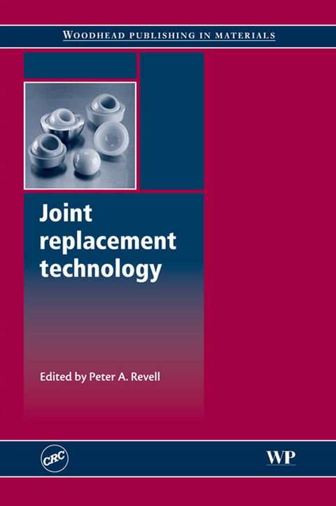 Joint Replacement Technology - 