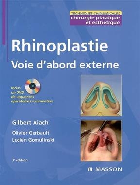 Rhinoplastie : voie d'abord externe - Gilbert Aiach