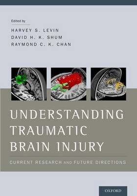 Understanding Traumatic Brain Injury - 