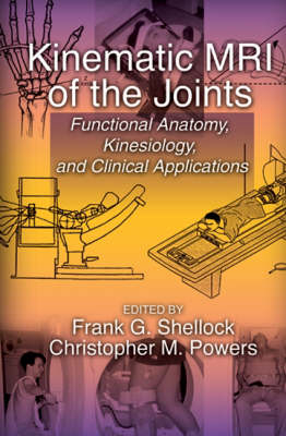 Kinematic MRI of the Joints - 