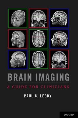 Brain Imaging -  Paul C. Lebby