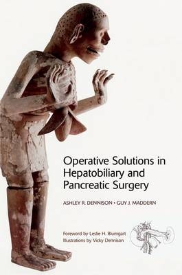 Operative Solutions in Hepatobiliary and Pancreatic Surgery -  Ashley R. Dennison,  Guy J. Maddern