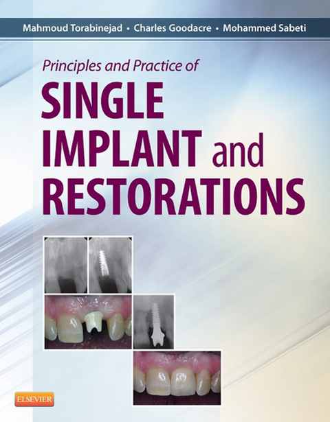 Principles and Practice of Single Implant and Restoration -  Charles Goodacre,  Mohammed Sabeti,  Mahmoud Torabinejad