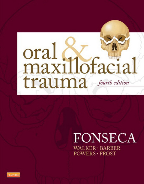 Oral and Maxillofacial Trauma -  Raymond J. Fonseca,  H. Dexter Barber,  Michael P. Powers,  David E. Frost