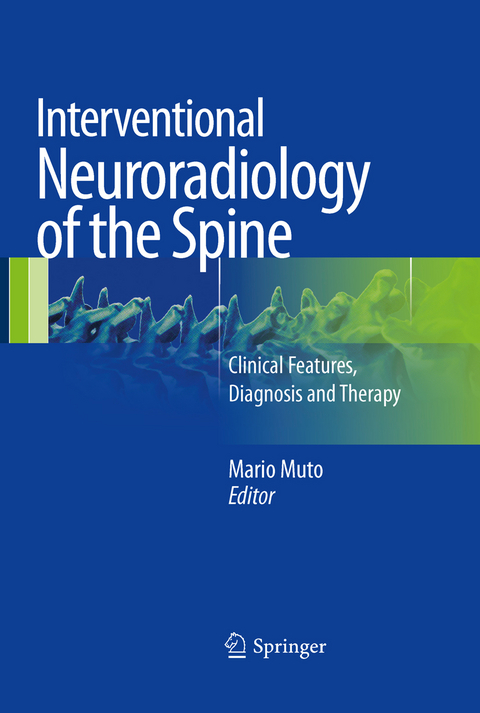 Interventional Neuroradiology of the Spine - 