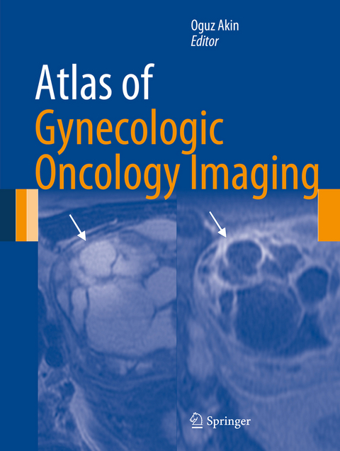 Atlas of Gynecologic Oncology Imaging - 