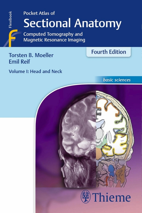 Pocket Atlas of Sectional Anatomy, Volume I: Head and Neck -  Torsten Bert Möller,  Emil Reif