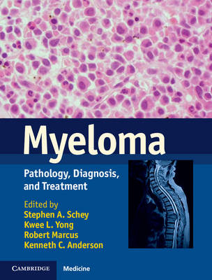 Myeloma - 