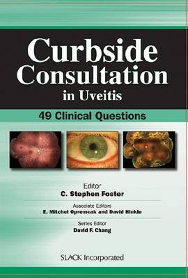 Curbside Consultation in Uveitis - 