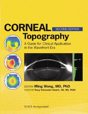 Corneal Topography - 