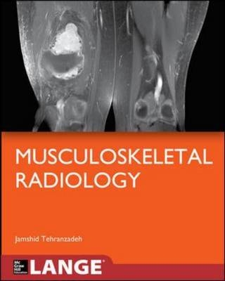 Basic Musculoskeletal Imaging -  Jamshid Tehranzadeh