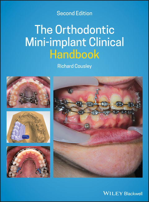 The Orthodontic Mini-implant Clinical Handbook - Richard Cousley