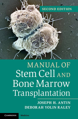 Manual of Stem Cell and Bone Marrow Transplantation -  Joseph H. Antin,  Deborah Yolin Raley