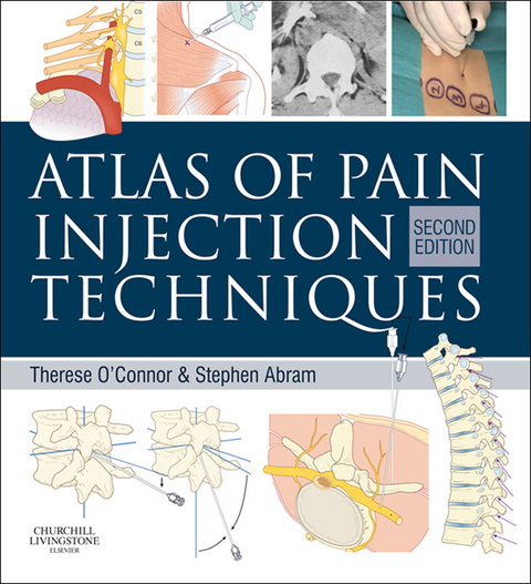 Atlas of Pain Injection Techniques E-Book -  Stephen E. Abram,  Therese C. O'Connor