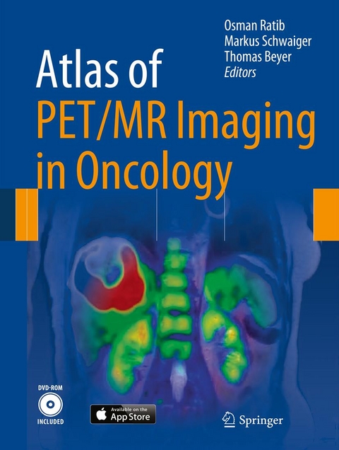 Atlas of PET/MR Imaging in Oncology - 