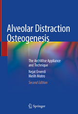 Alveolar Distraction Osteogenesis - Erverdi, Nejat; Motro, Melih