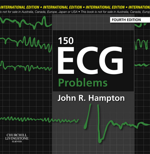 150 ECG Problems E-Book -  John Hampton