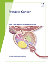 Fast Facts: Prostate Cancer - Roger S. Kirby, Manish I. Patel, Darren M.C. Poon